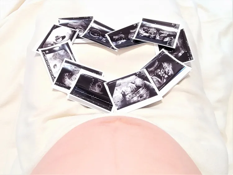 マタニティフォト撮るならサッシュベルトがおすすめ！サッシュベルトの作り方やおすすめの小物まで解説8